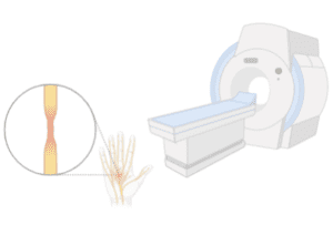 mri