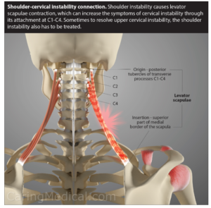 Frozen Shoulder and Its Connection to Other Diseases