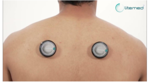 treatment for frozen shoulder